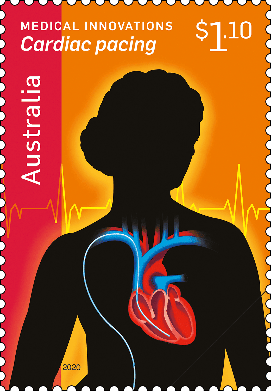 Medical Innovations Cardiac pacing stamp Medical Innovations